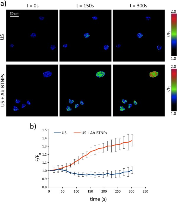 UltrasoundActivated Piezoelectric Nanoparticles Inhibit Proliferation