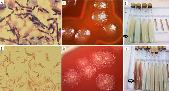 spore-forming bacteria