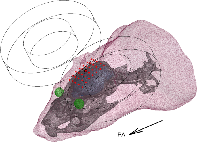 Individual head models for estimating the TMSinduced