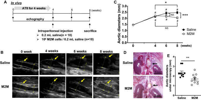 Administration of anti-inflammatory M2 macrophages suppresses ...