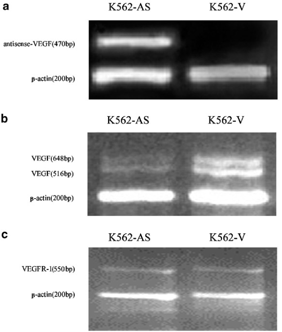 (PDF) Inhibition of K562 leukemia angiogenesis and growth 
