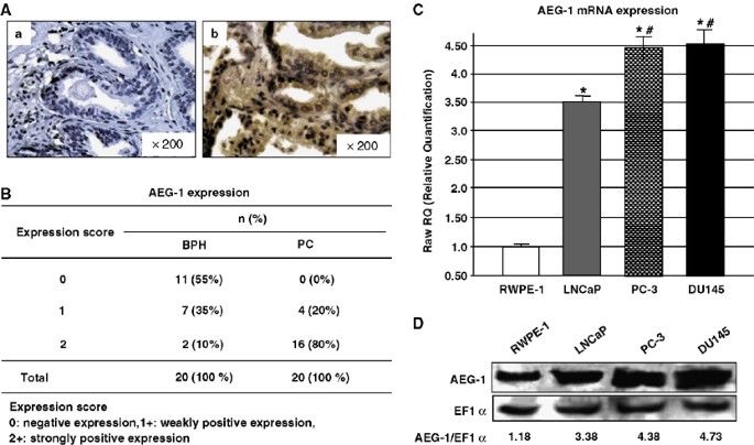 DLGAP1-AS1 knockdown inhibits tumor growth in vivo. (A 