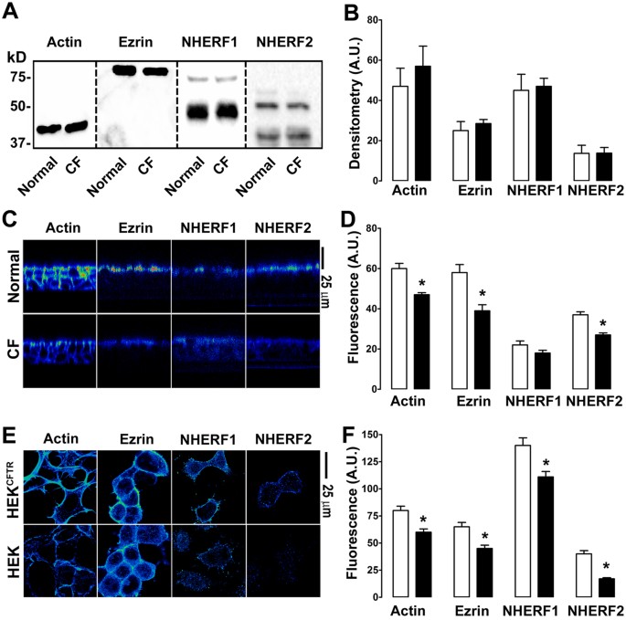 The Cystic Fibrosis Transmembrane Conductance Regulator ...