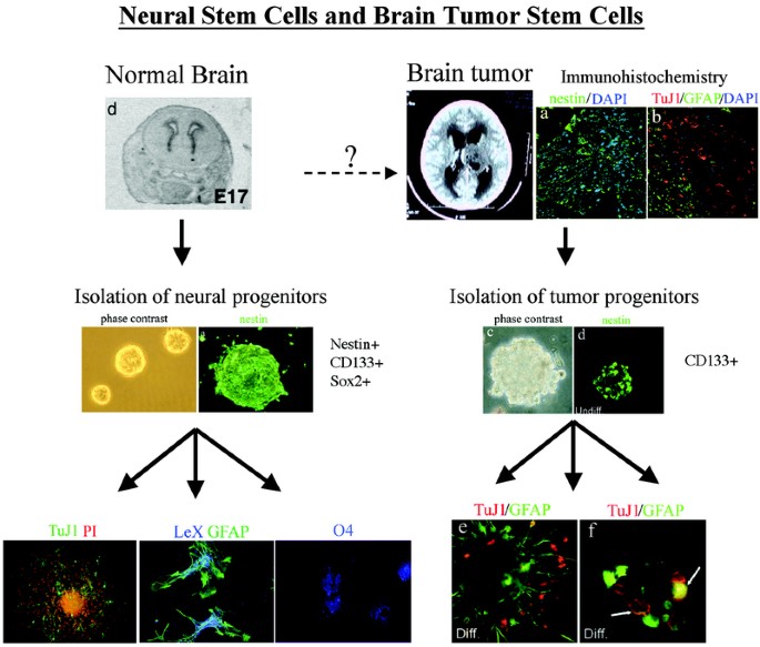 Brain Tumor Stem Cells Pediatric Research