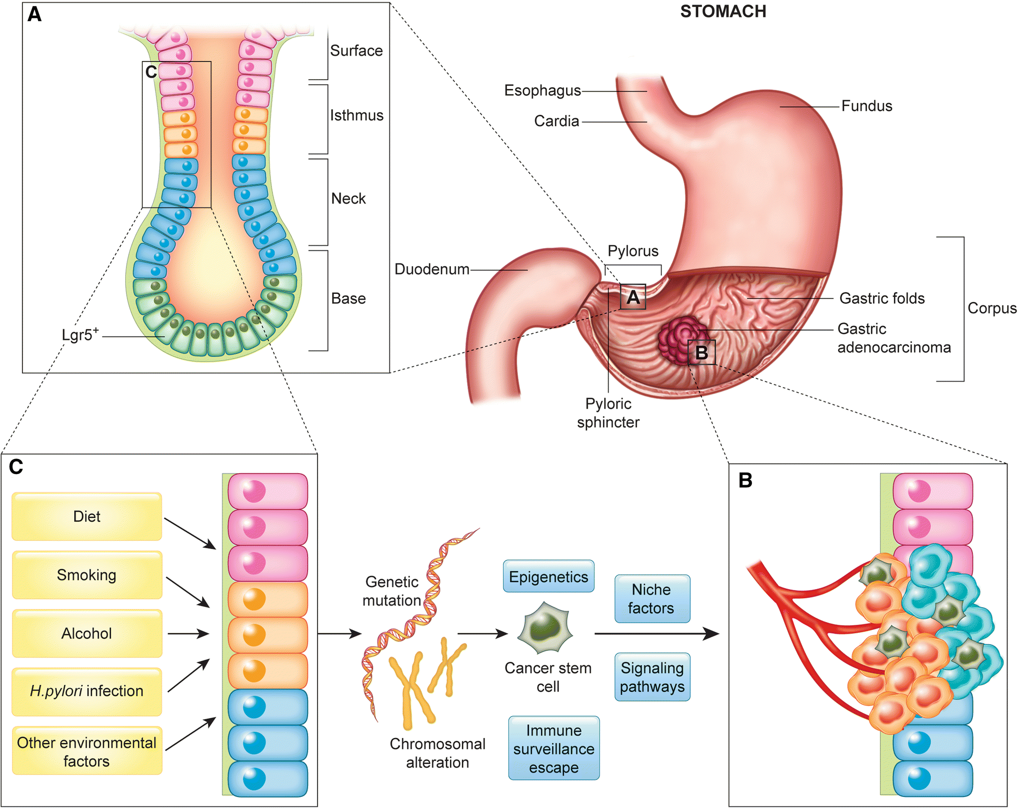 Helicobacter Pylori Infection And Gastric Cancer Biology