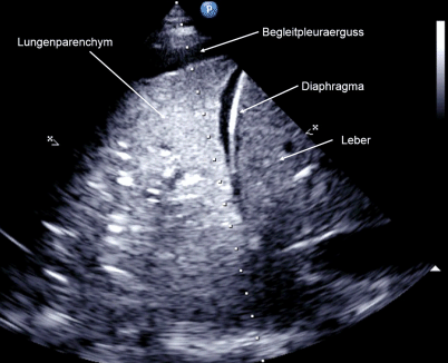 Strukturierte bettseitige Sonographie in der ...