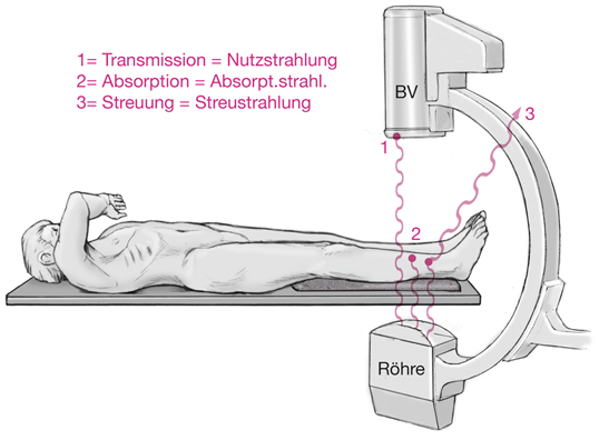 Röntgen in Unfallchirurgie und Orthopädie | SpringerLink