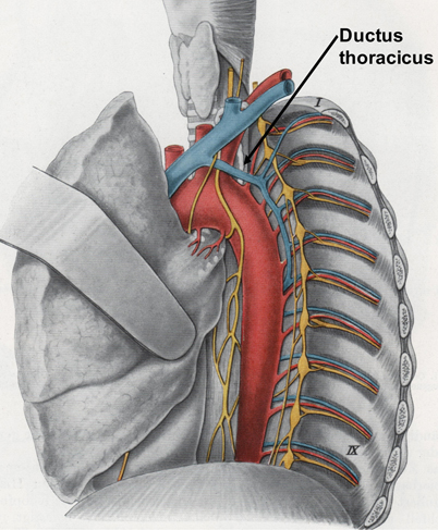 Therapiemanagement Des Chylothorax SpringerLink therapiemanagement-des-chylothorax-springerlink