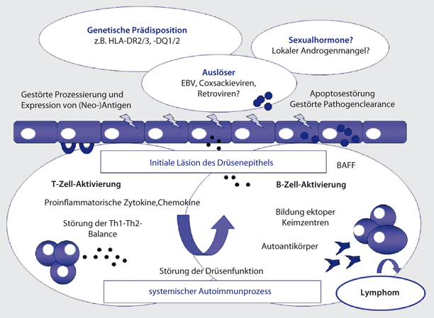 Sjögren-Syndrom  SpringerLink