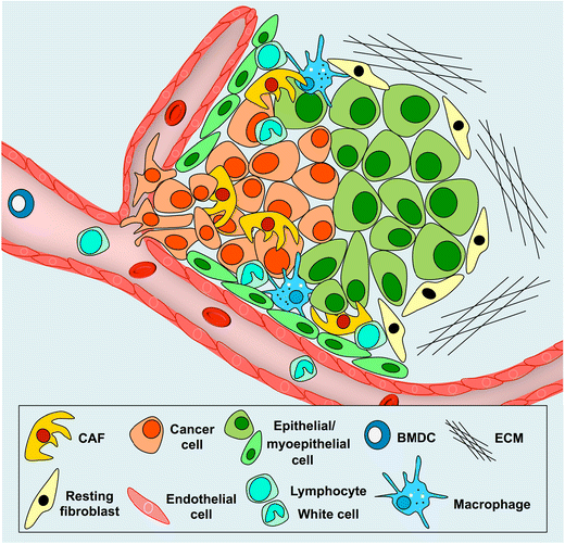 Metabolic Implication Of Tumor:stroma Crosstalk In Breast Cancer ...