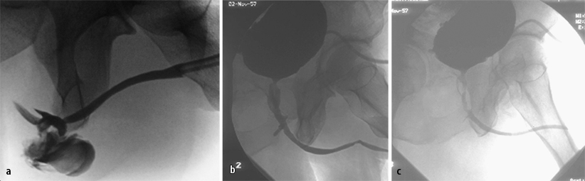 Verletzungen des unteren Harntrakts und des Urogenitalsystems ...