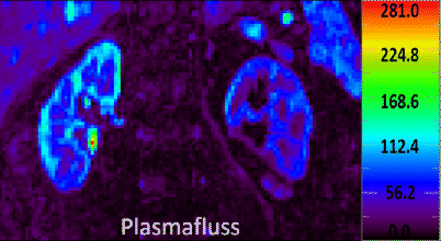 Funktionelle Magnetresonanztomographie Der Nieren Springerlink