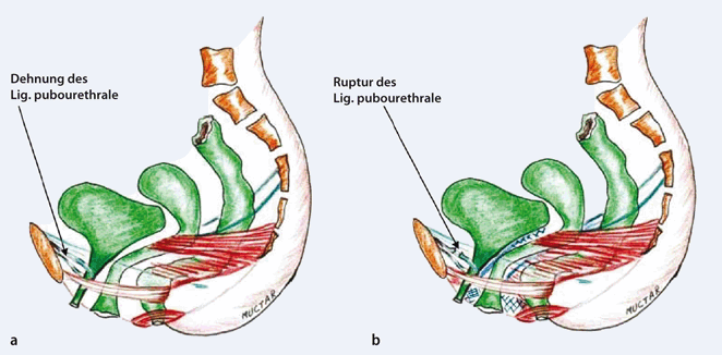 Funktionelle Anatomie Des Weiblichen Beckenbodens Springerlink - 