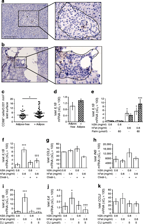 Metabolic Crosstalk Between Fatty Pancreas And Fatty Liver - 