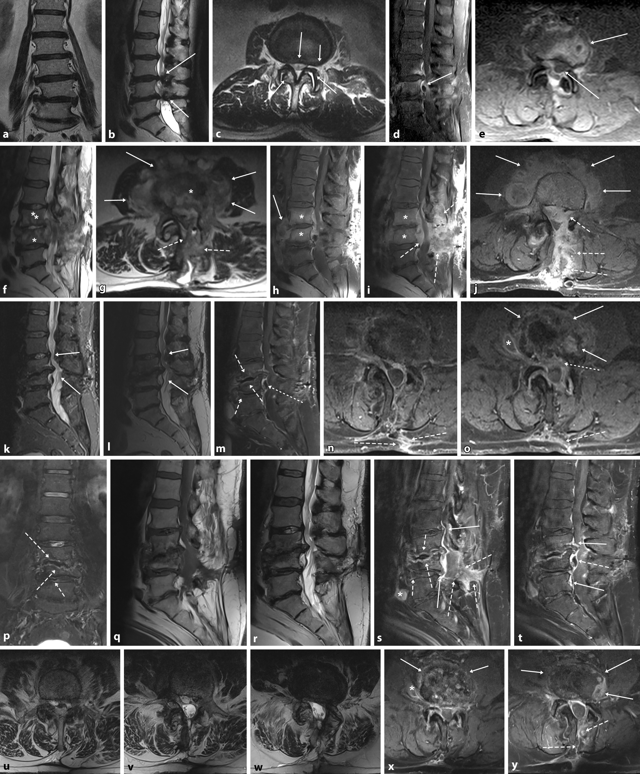 progredient bedeutung