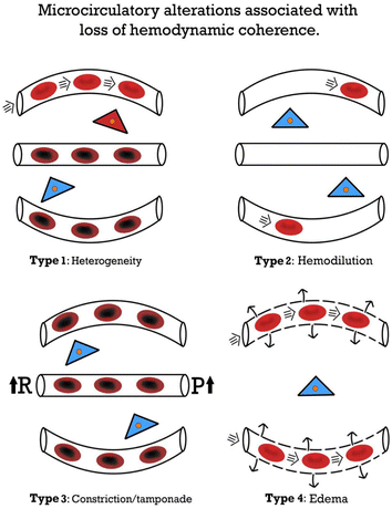 selective multiple quantum coherence lactate selective multiple quantum coherence lactate