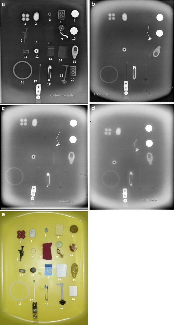 Foreign bodies radiopaque compared to what? SpringerLink