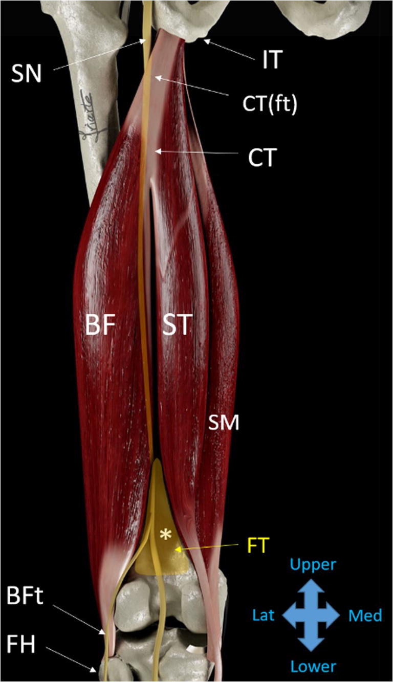Sonographic landmarks in hamstring muscles | SpringerLink fibular head diagram 