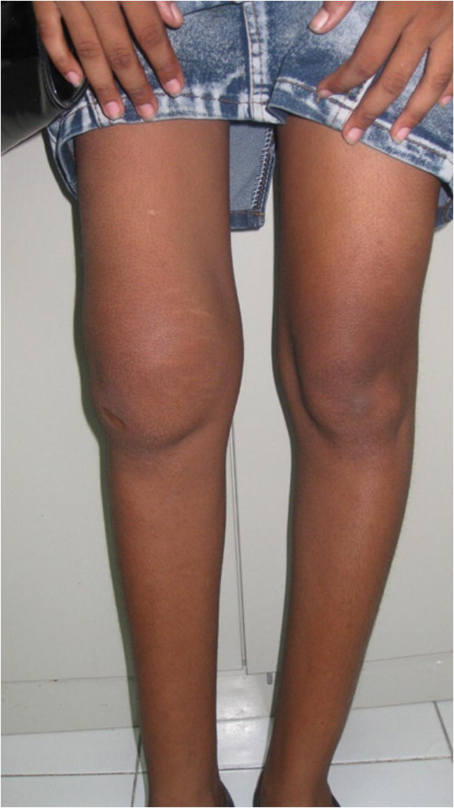 Test yourself question and answer question painful knee swelling