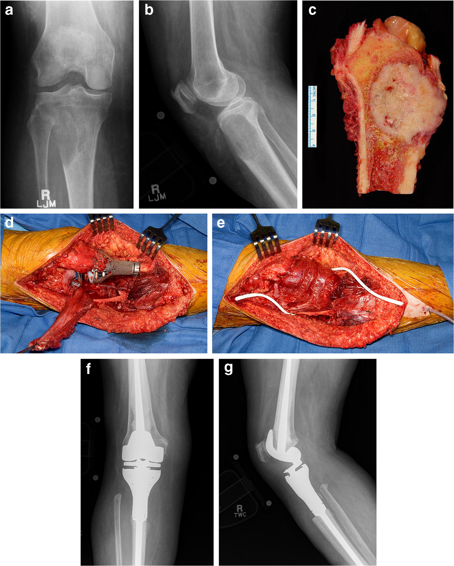 tratament articular tao