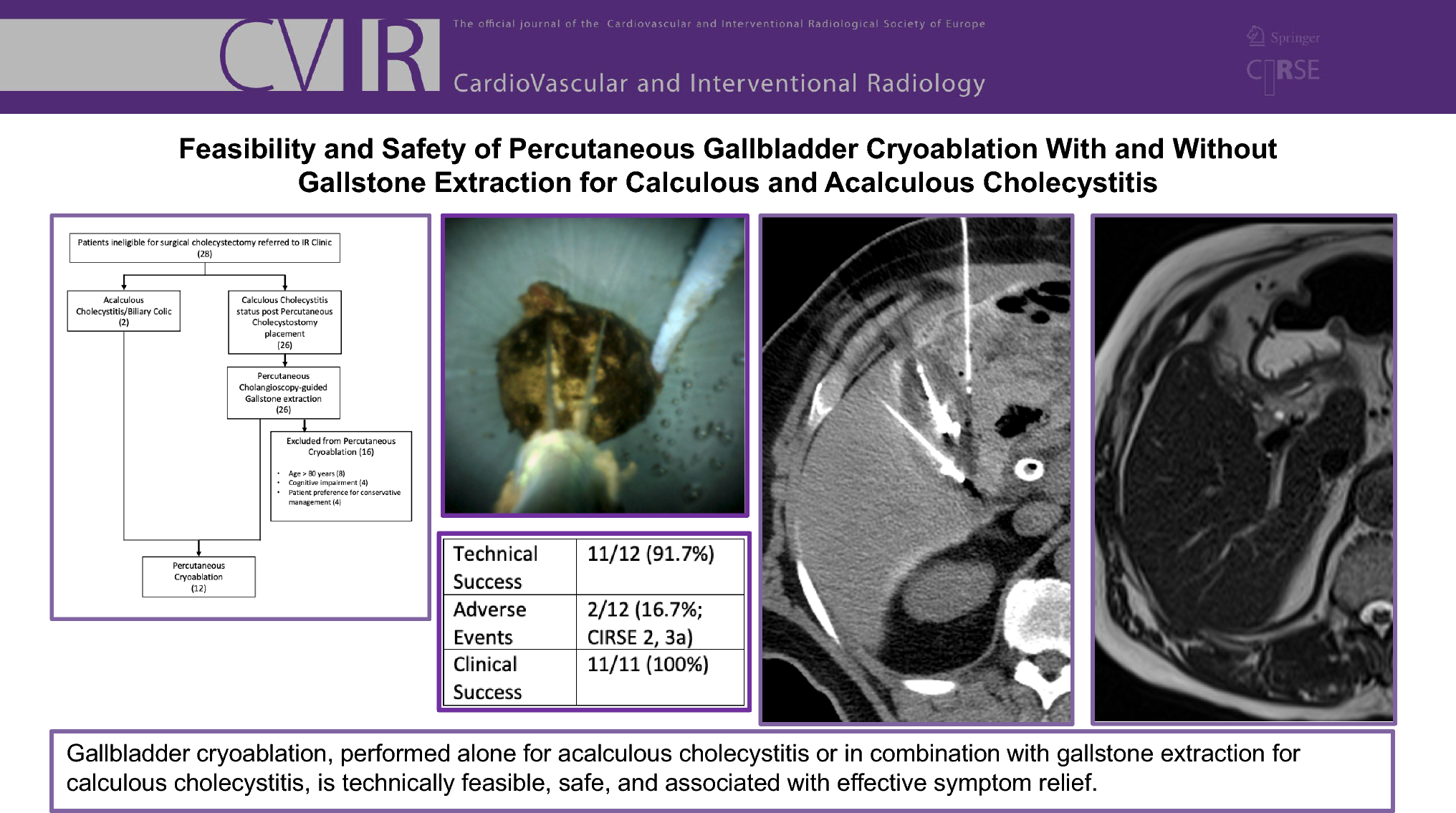 Cholecystitis | Feasibility and Safety of Percutaneous Gallbladder ...