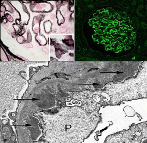 synthetic aspects of aminodeoxy