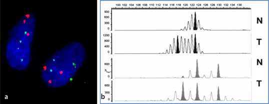 Mikrosatelliteninstabilität SpringerLink
