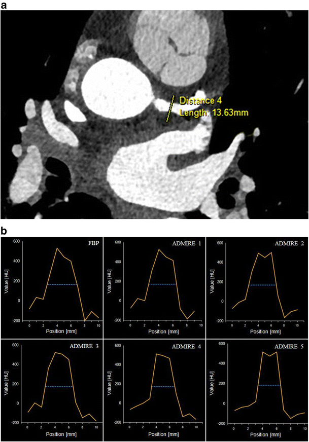 Optimizing radiation dose by using advanced modelled iterative