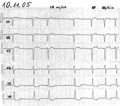 Hydroxychloroquine Dosages Interactions Link To Covid19 Hydroxychloroquine Dosages Interactions Link To Covid19