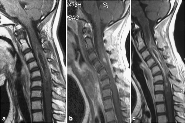 Tadalafil aristo 20 mg kaufen ohne rezept