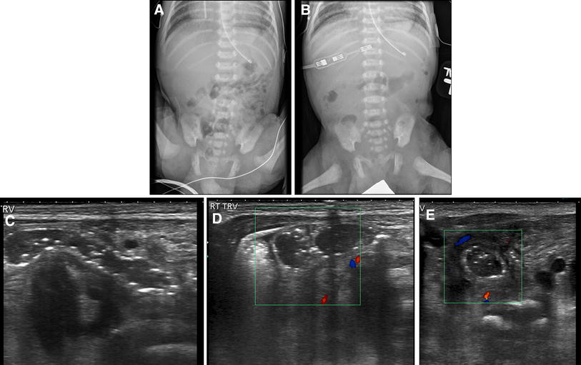 Prospective evaluation of the impact of sonography on the management