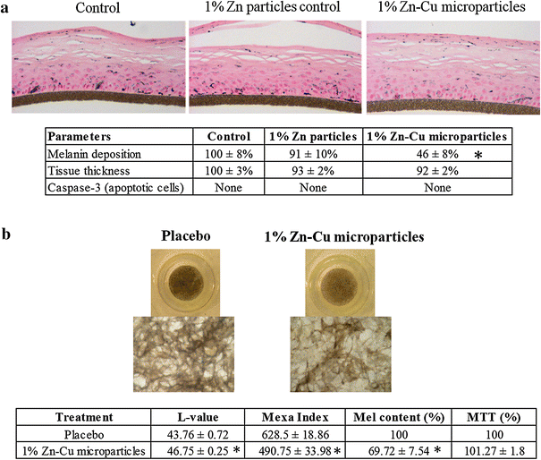 Galvanic zincâ€