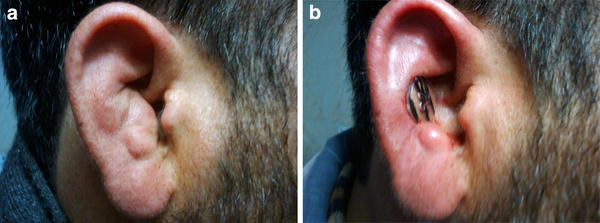 Clinical characteristics and comparative study of different modalities ...