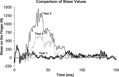 Investigation Of An Alleged Mechanism Of Finger Injury In An Automobile Crash Springerlink