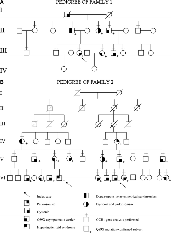 Segawa syndrome due to mutation Q89X in the GCH1 gene: a possible ...