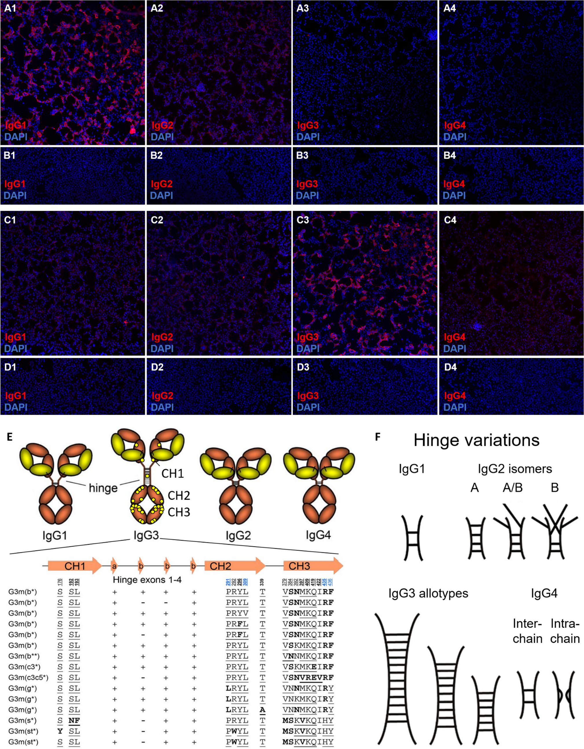 Improving the sensitivity of myelin oligodendrocyte glycoprotein-antibody  testing: exclusive or predominant MOG-IgG3 seropositivity—a potential  diagnostic pitfall in patients with MOG-EM/MOGAD | springermedizin.de