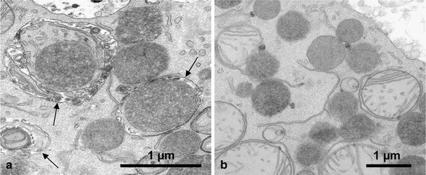 Degradation of excess peroxisomes in mammalian liver cells by autophagy