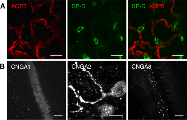 Alveolar Epithelial Cnga1 Channels Mediate Cgmp Stimulated Amiloride Insensitive Lung Liquid Absorption Springerlink Alveolar Epithelial Cnga1 Channels Mediate Cgmp Stimulated Amiloride Insensitive Lung Liquid Absorption Springerlink