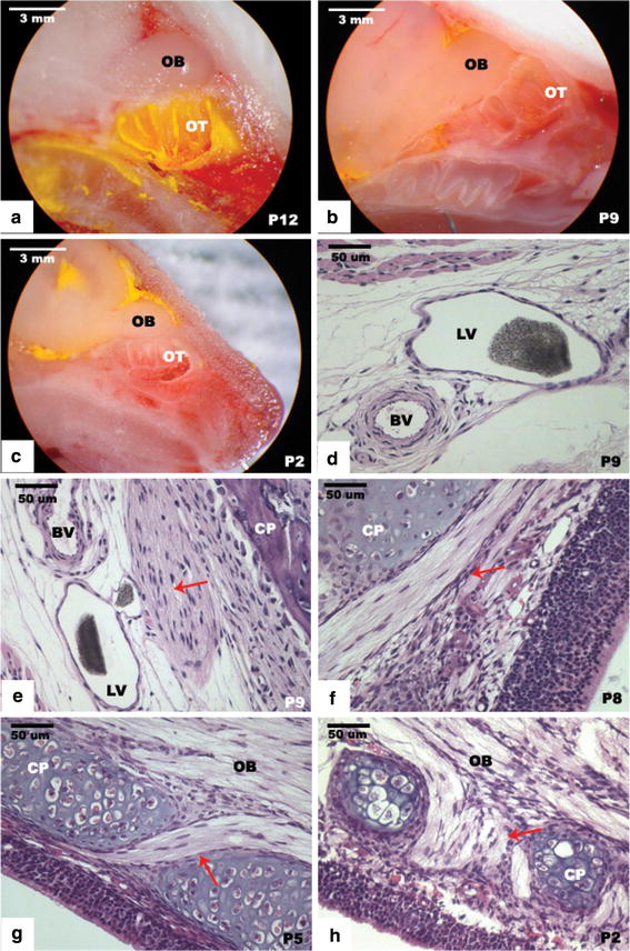 Development of cerebrospinal fluid absorption sites in the pig and rat