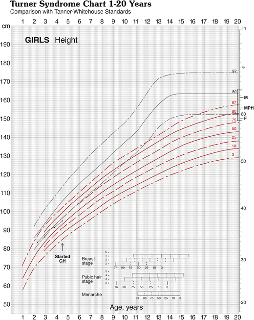 Turner Syndrome Growth Chart Pdf