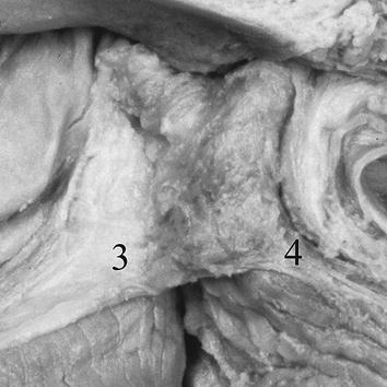superior constrictor muscle superior constrictor muscle