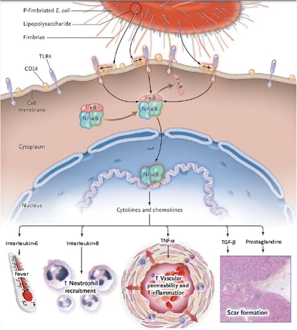 Acute pyelonephritis in children | SpringerLink