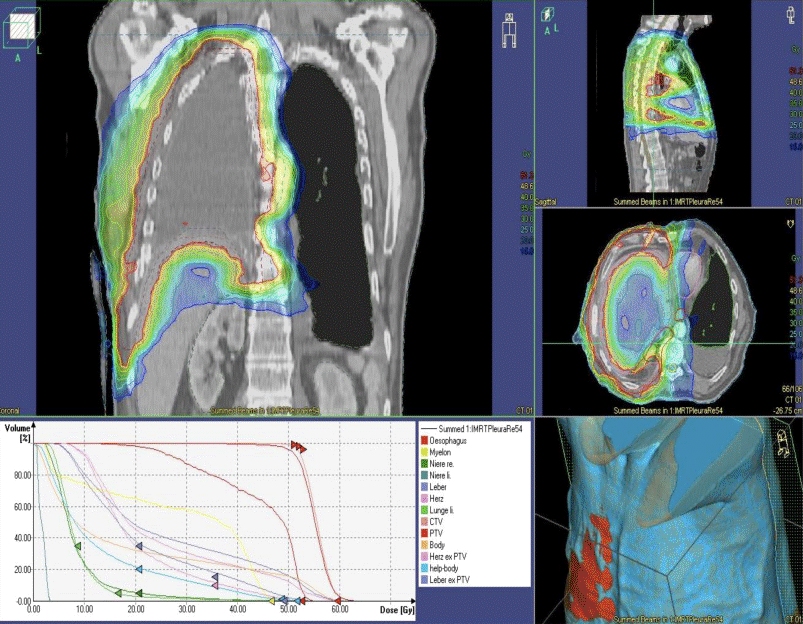 Management of malignant pleural mesothelioma—part 2: therapeutic