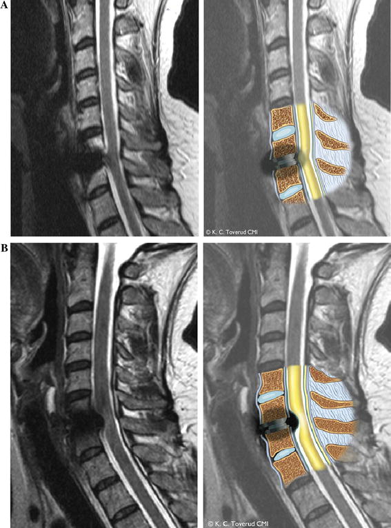 resonance imaging evaluation after implantation of a titanium