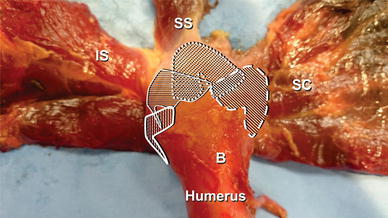 The clinical anatomy of the insertion of the rotator cuff tendons
