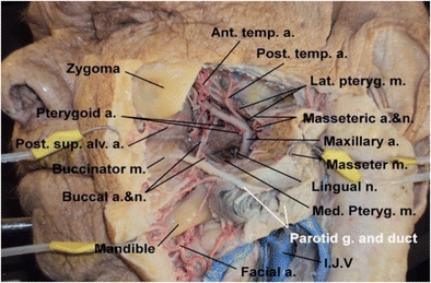 The maxillary artery and its variants: an anatomical study with