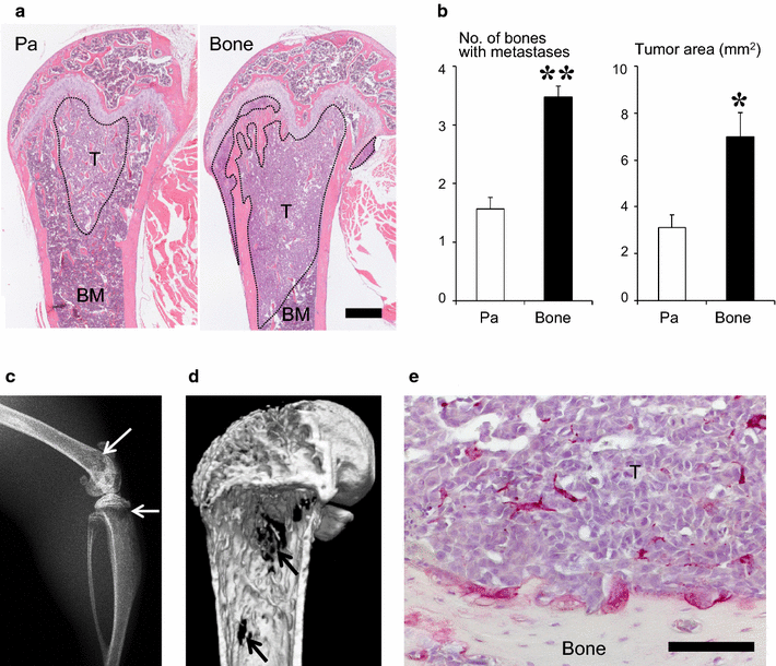 Establishment and characterization of a C57BL/6 mouse model of bone