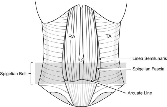 Contemporary thoughts on the management of Spigelian hernia | SpringerLink