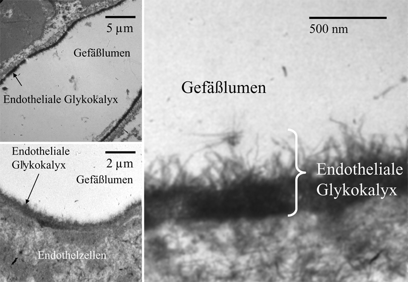 Die Bedeutung der endothelialen Glykokalyx für die Infusionspraxis in ...