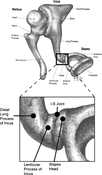 Anatomy Of The Distal Incus In Humans Springerlink